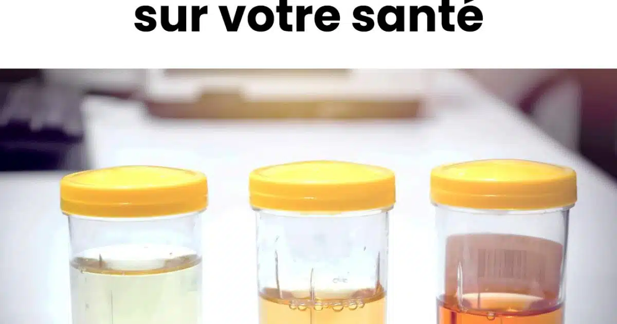 Voici ce que la couleur de votre urine révèle sur votre santé