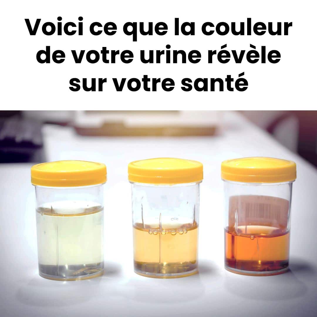 Voici ce que la couleur de votre urine révèle sur votre santé