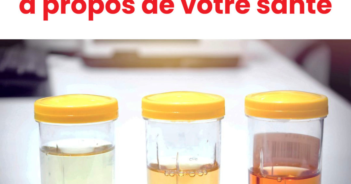 Voici ce que révèle la couleur de votre urine à propos de votre santé