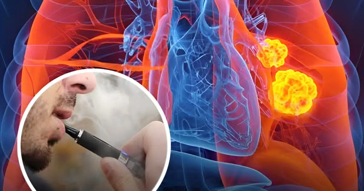 Voici ce qui arrive à votre corps lorsque vous arrêtez le vapotage pendant 90 jours