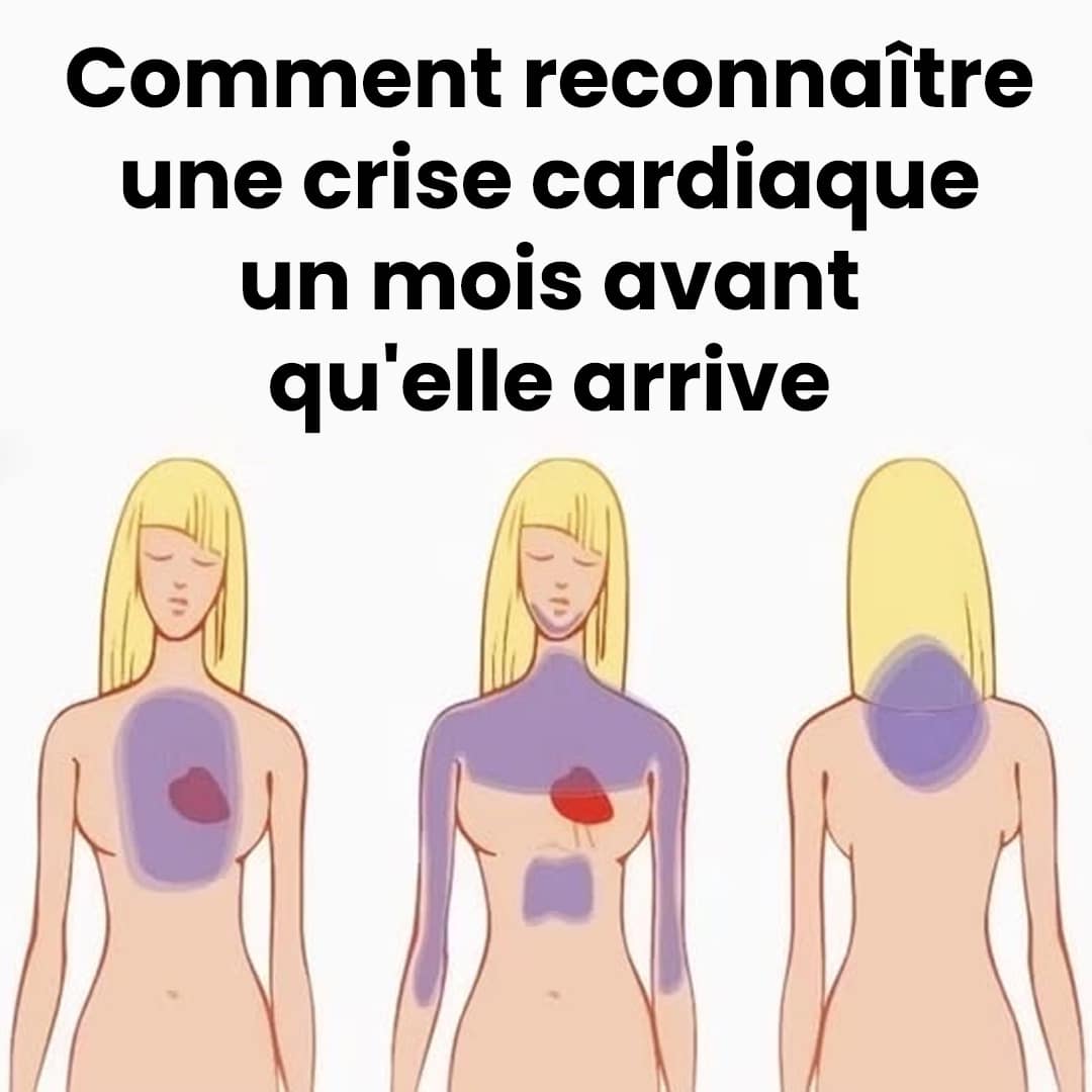 Voici comment reconnaître une crise cardiaque des semaines avant qu'elle n'arrive