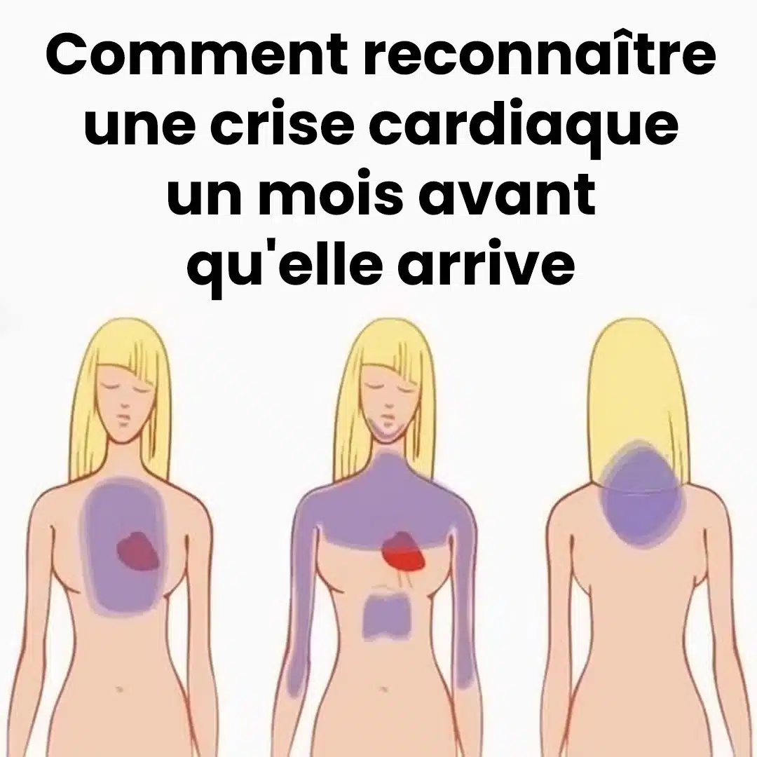 Voici comment reconnaître une crise cardiaque des semaines avant qu'elle n'arrive