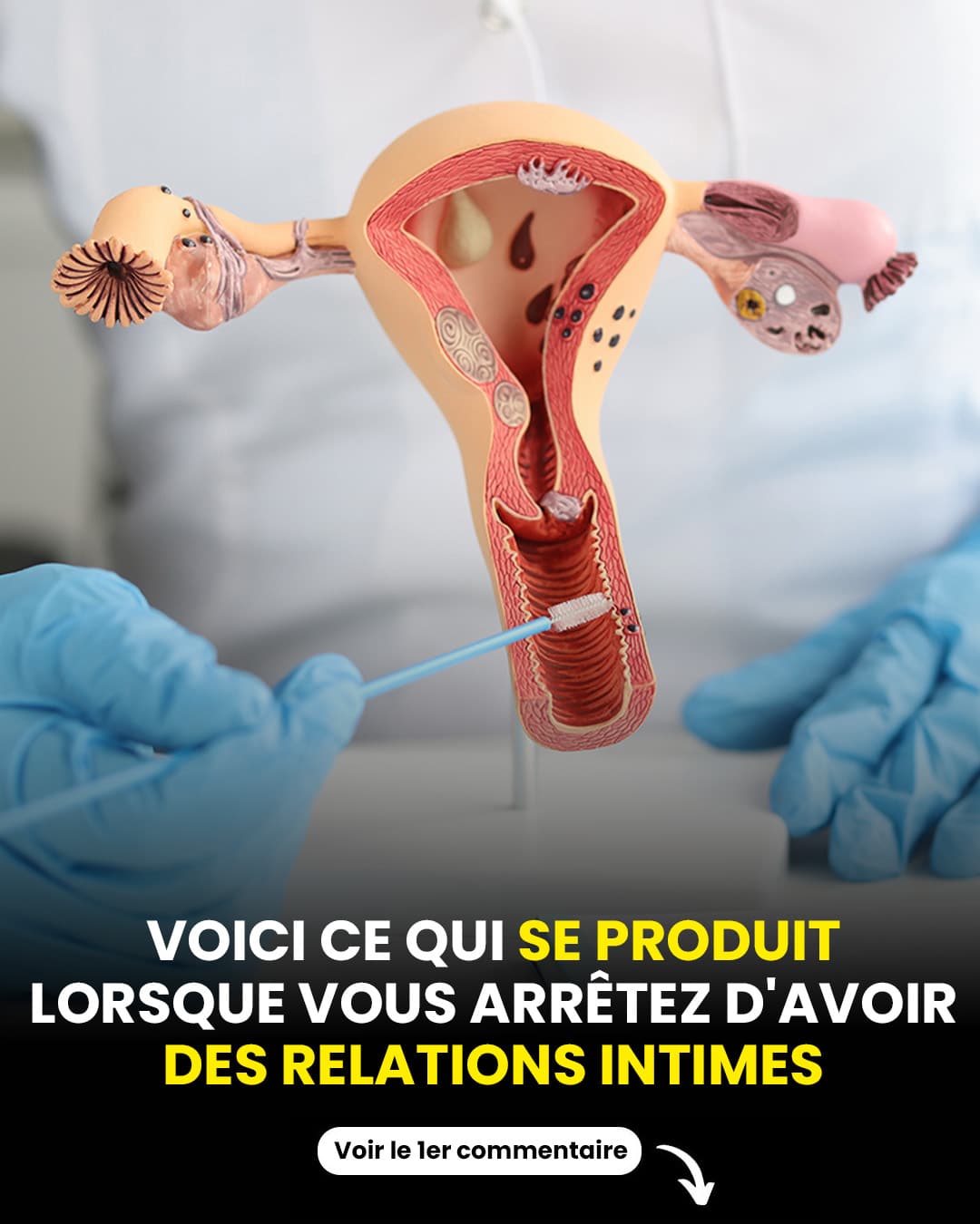 Voici les conséquences d’une absence de vie de couple