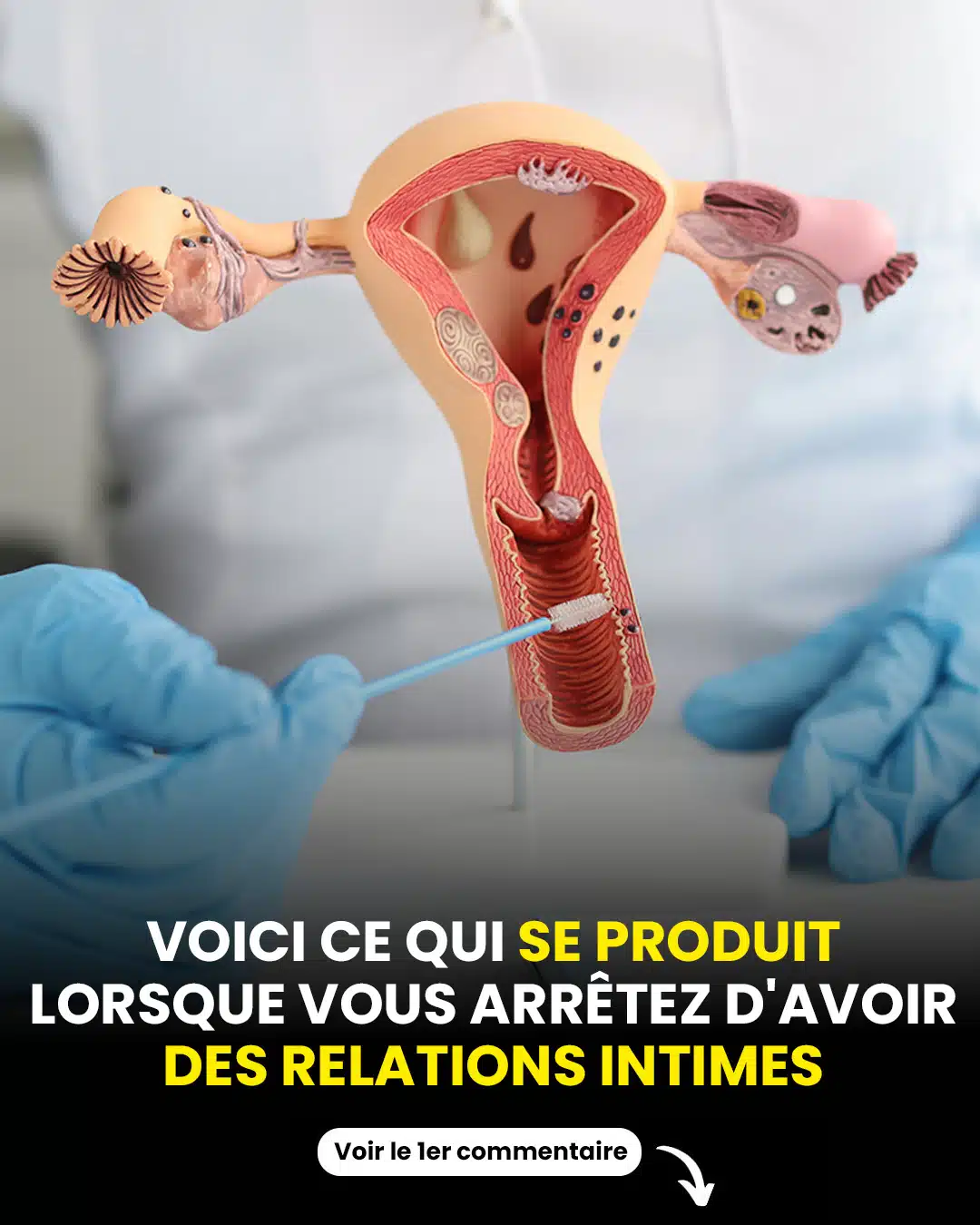 Voici les conséquences d’une absence de vie de couple