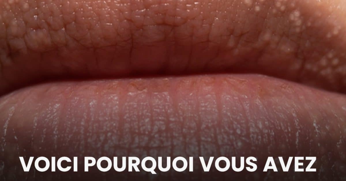 Voici pourquoi vous avez des petits points blancs sur les lèvres et les parties intimes