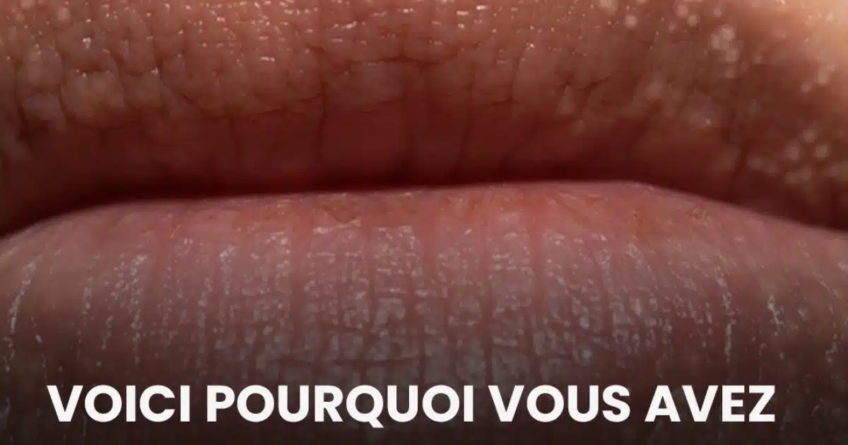Voici pourquoi vous avez des petits points blancs sur les lèvres et les parties intimes