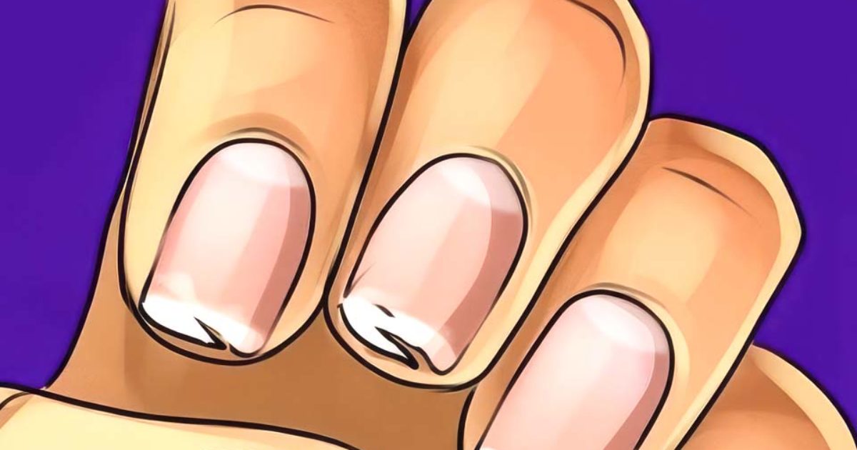 Vos ongles se fissurent ou se dédoublent sans arrêt ? Voici le message que votre corps cherche à vous transmettre