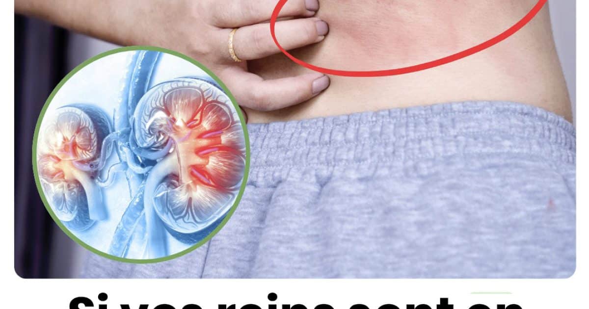 Votre corps vous enverra ces 10 signes si vos reins sont en danger