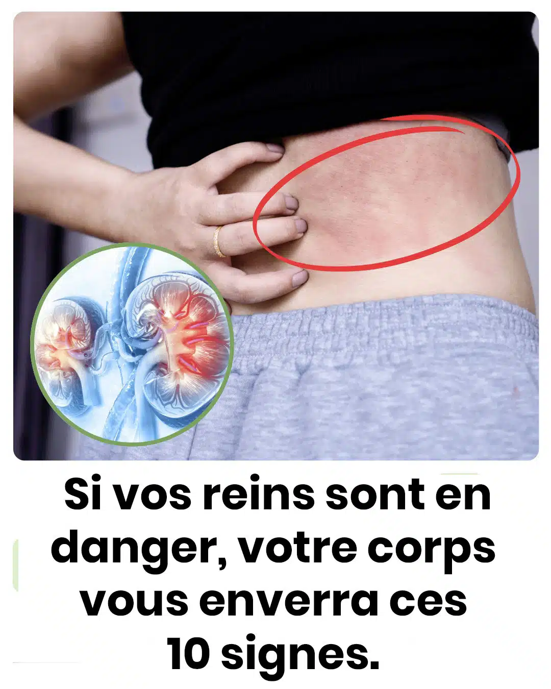 Votre corps vous enverra ces 10 signes si vos reins sont en danger