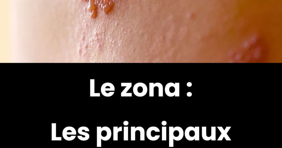 Zona : symptômes, complications et prévention